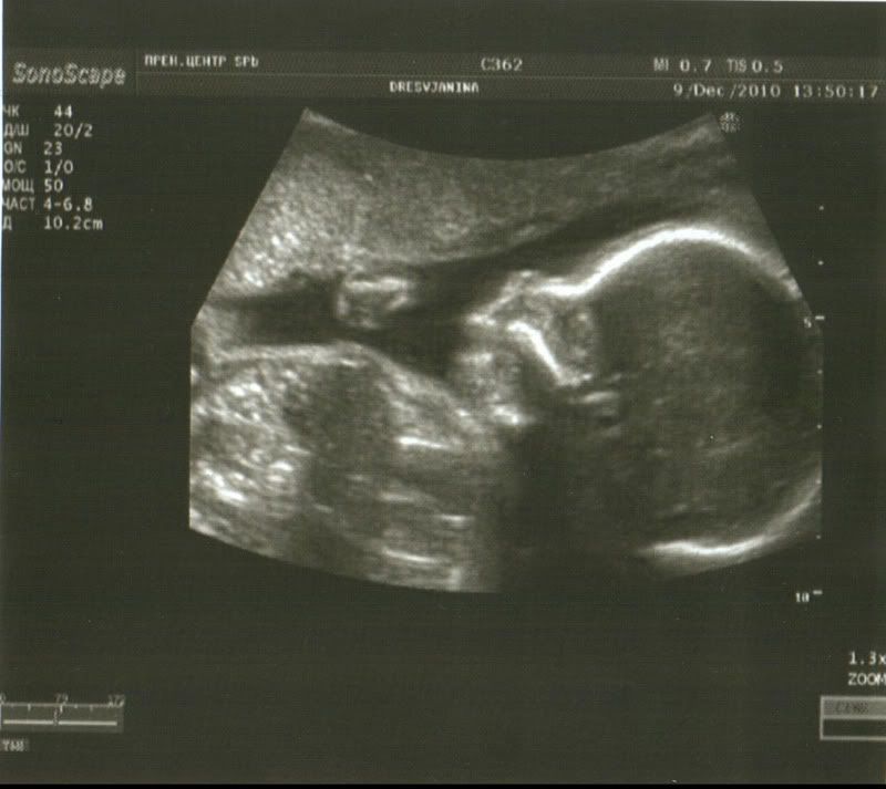 мальчик растет Photobucket