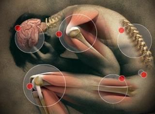 pain photo: FibromyalgiaThe pain associated with fibromyalgia often is described as a constant dull ache, typically arising from muscles. To be considered widespread, the pain must occur on both sides of your body and above and below your waist.Fibromyalgia 397813_206990052730846_1260924338_n.jpg